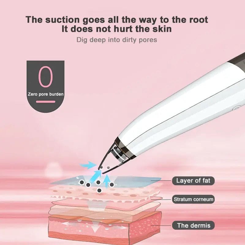 Black Spot Suction Vacuum, Blackhead Remover Cleaning Device, Electric Facial Pore Cleaner, Skincare Exfoliating Beauty Device, Facial Pore Acne Pimple Cleaner, Facial Tag Vacuum Suction, Household Professional Facial Pore Pimple Cleanser Black Spot Suction Vacuum, Blackhead Remover Cleaning Device, Electric Facial Pore Cleaner, Skincare Exfoliating Beauty Device, Facial Pore Acne Pimple Cleaner, Facial Tag Vacuum Suction, Household Professional Facial Pore Pimple Cleanser